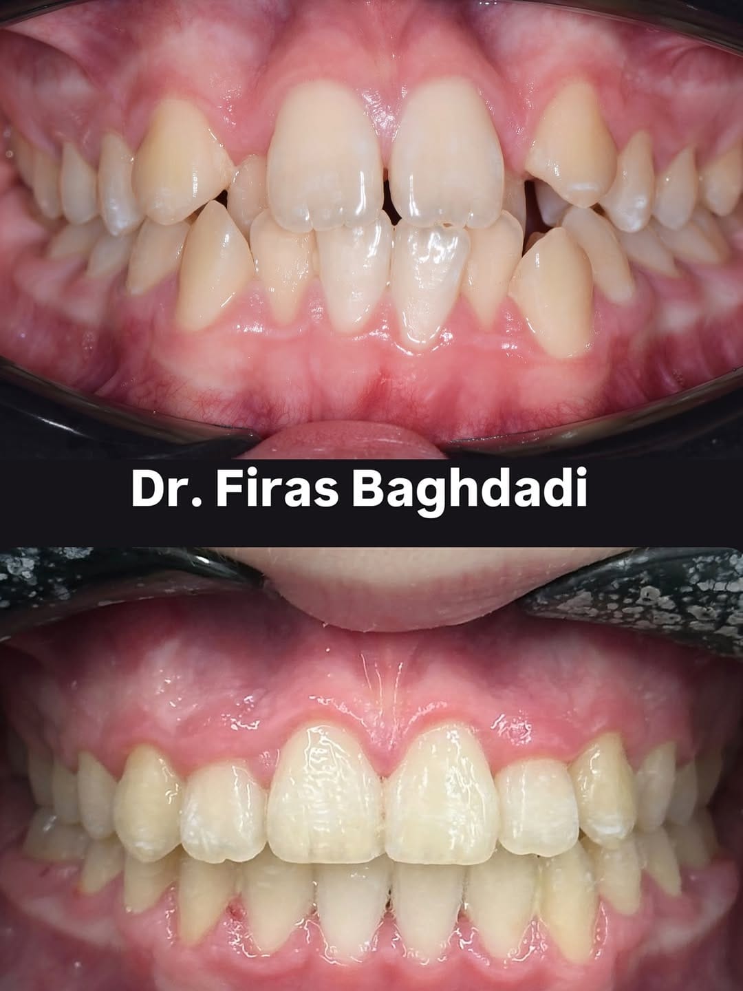 Post 10 by Dr Firas Baghdadi DMD on Instagram (carousel)