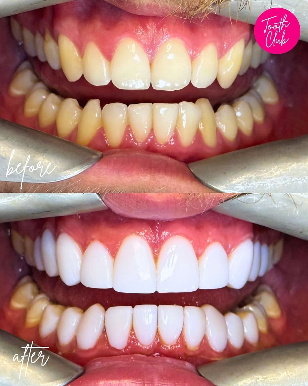 Post 10 by Tooth Club on Instagram (image)