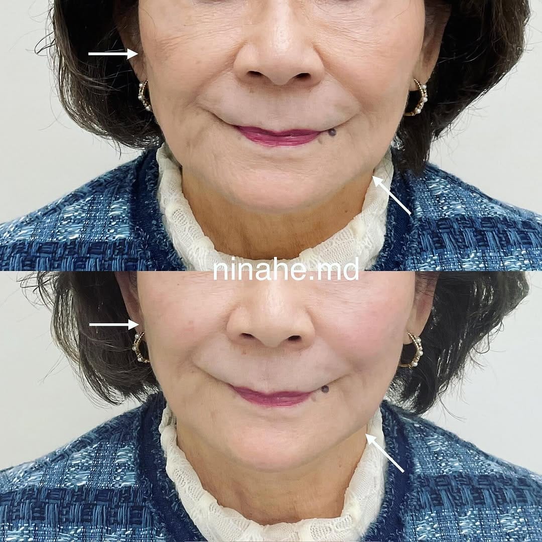 Post 10 by Dr. Nina He on Instagram (carousel)