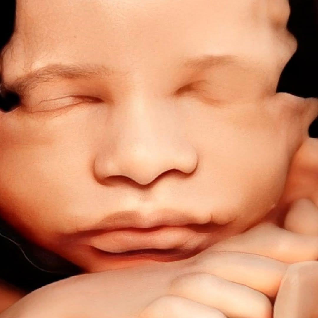 Post 10 by Medicina Fetal • Terapia Fetal • Embarazo on Instagram (carousel)