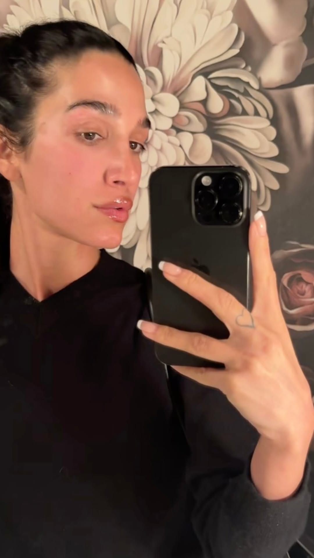Post 8 by Glow Dermal Therapy on Instagram (video)