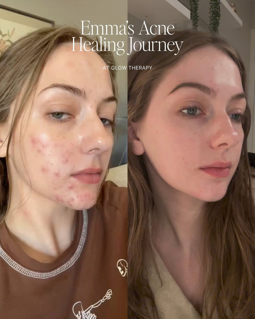 Post 6 by Glow Dermal Therapy on Instagram (carousel)