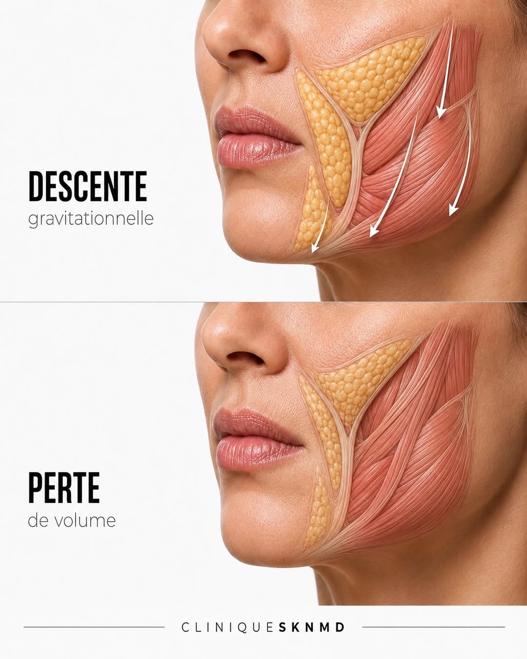 Post 1 by 𝐂𝐋𝐈𝐍𝐈𝐐𝐔𝐄 𝐒𝐊𝐍 𝐌𝐃 - DERMAL FILLERS | BOTOX® on Instagram (carousel)