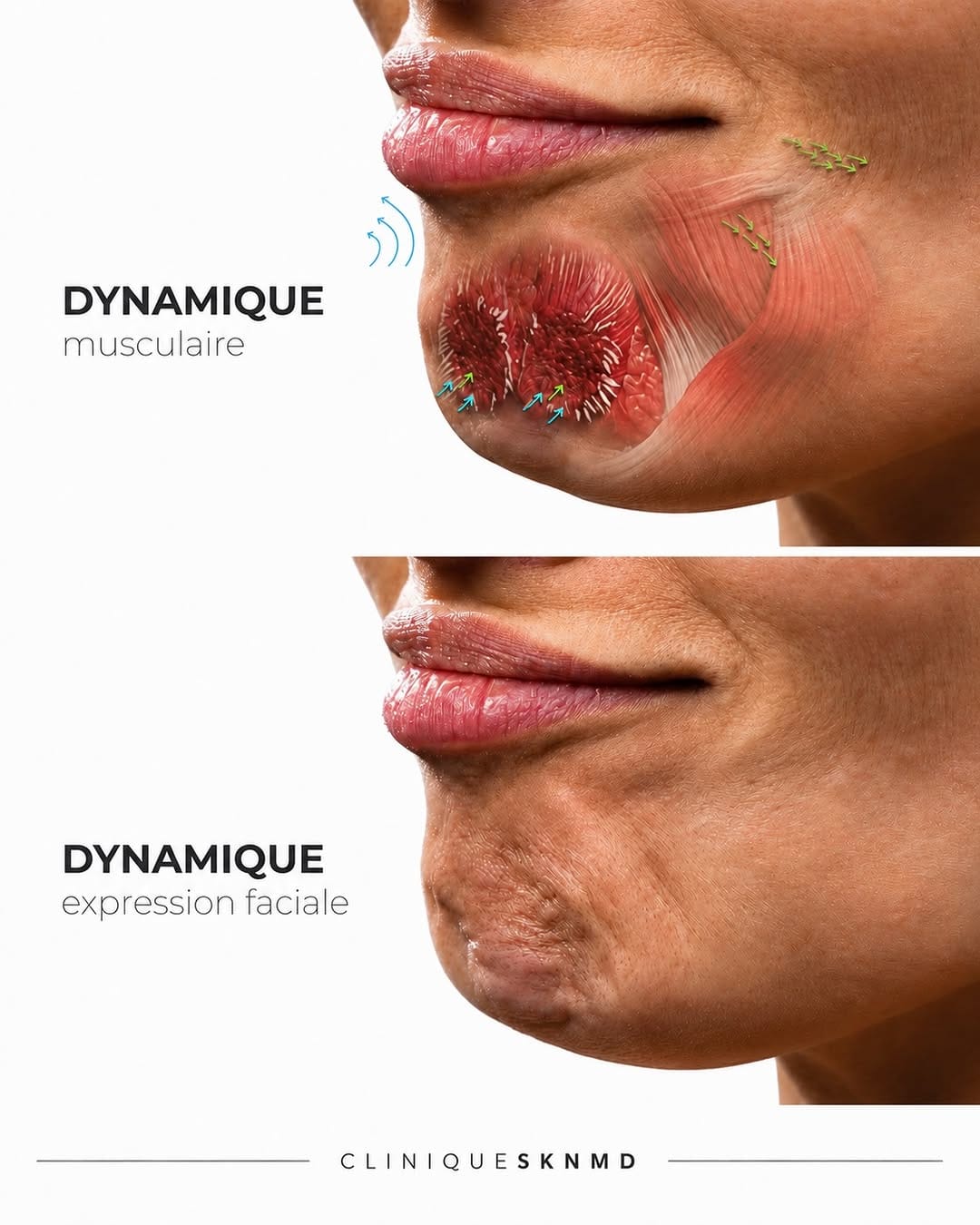 Post 5 by 𝐂𝐋𝐈𝐍𝐈𝐐𝐔𝐄 𝐒𝐊𝐍 𝐌𝐃 - DERMAL FILLERS | BOTOX® on Instagram (carousel)