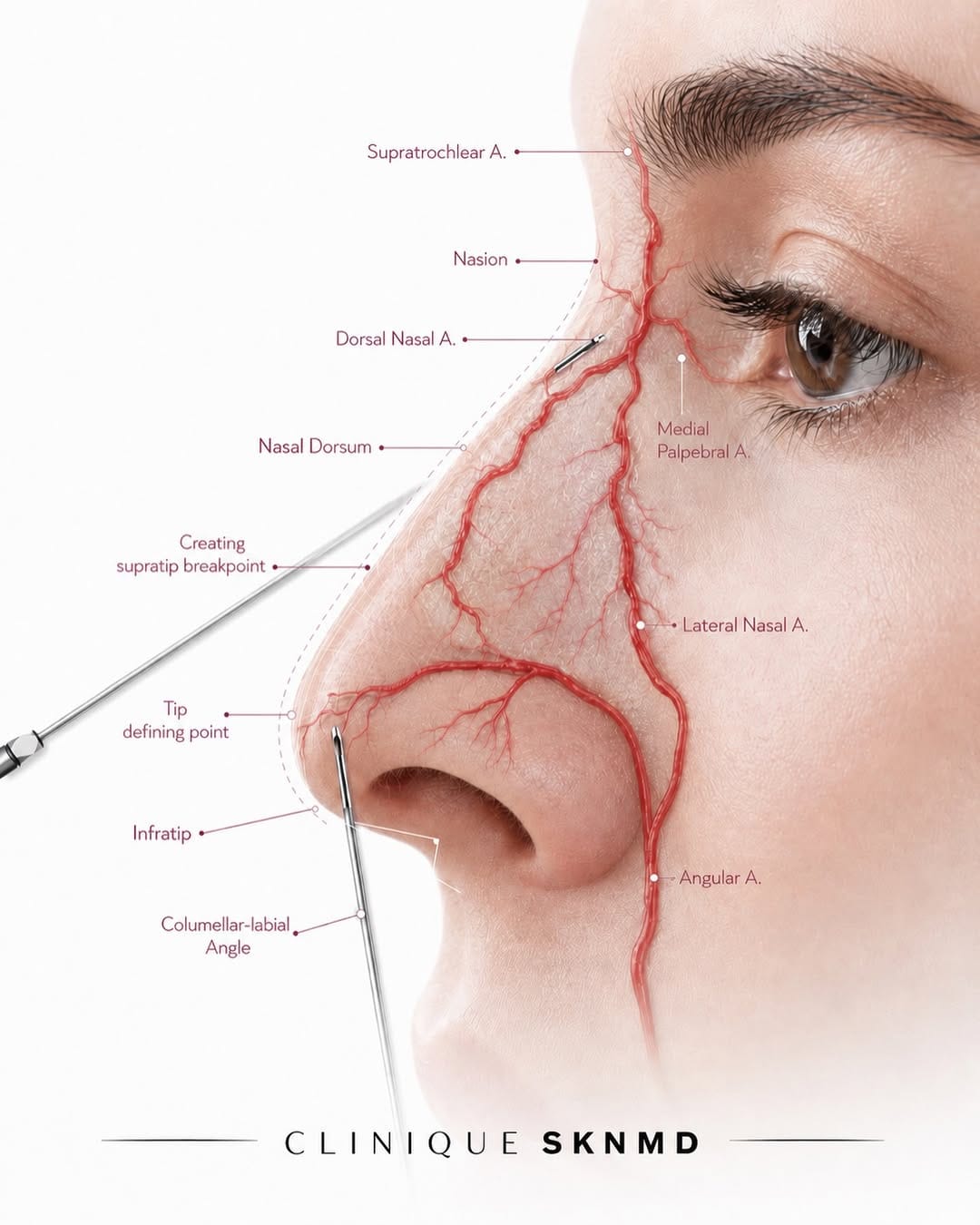 Post 3 by 𝐂𝐋𝐈𝐍𝐈𝐐𝐔𝐄 𝐒𝐊𝐍 𝐌𝐃 - DERMAL FILLERS | BOTOX® on Instagram (image)