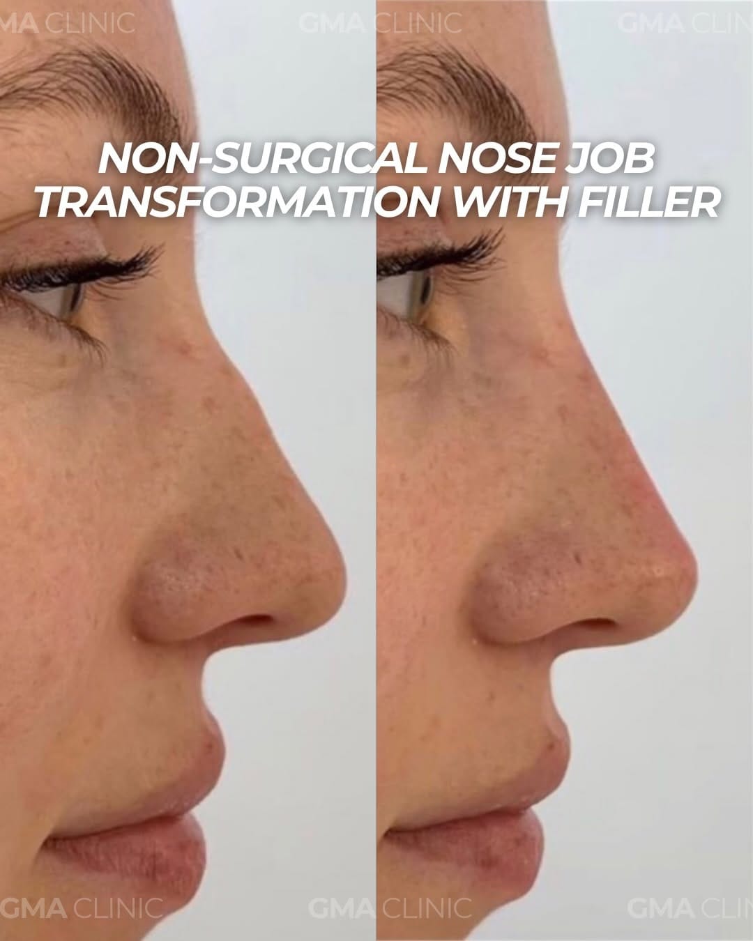 Post 7 by BOTOX | FILLERS | LASER | FACIALS on Instagram (carousel)
