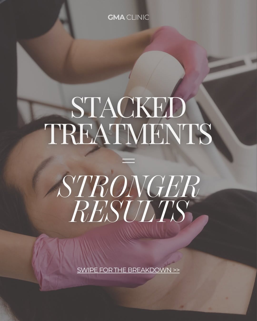 Post 6 by BOTOX | FILLERS | LASER | FACIALS on Instagram (carousel)