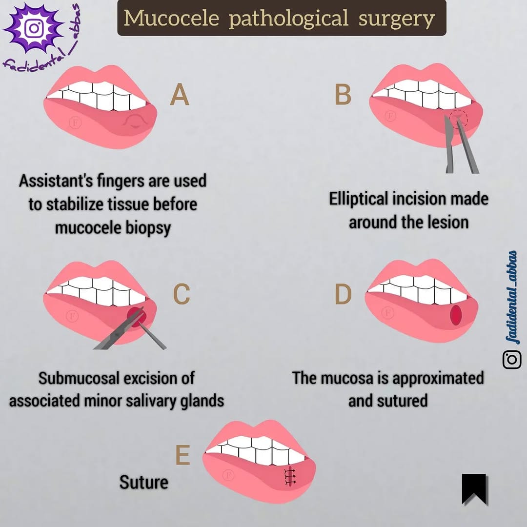 Post 8 by Dr. Fadi Al Abbas on Instagram (image)