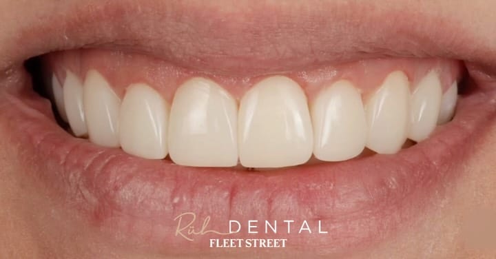 Post 5 by DR PETE NIESIOLOWSKI BDS PGdip PGCert on Instagram (carousel)