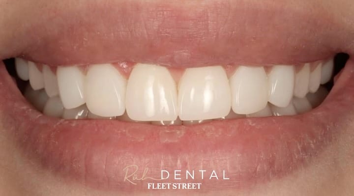 Post 6 by DR PETE NIESIOLOWSKI BDS PGdip PGCert on Instagram (carousel)