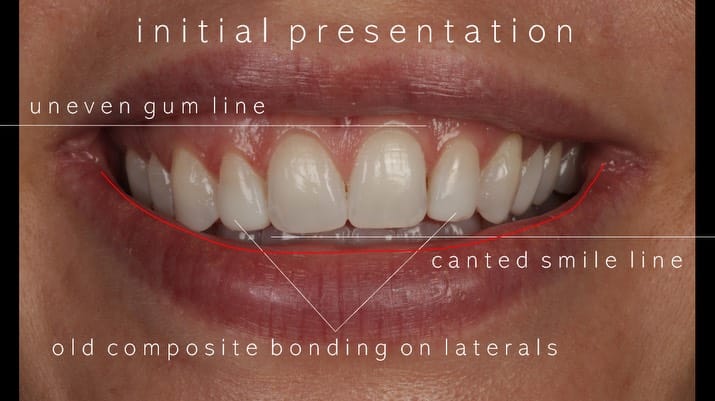 Post 4 by DR PETE NIESIOLOWSKI BDS PGdip PGCert on Instagram (carousel)