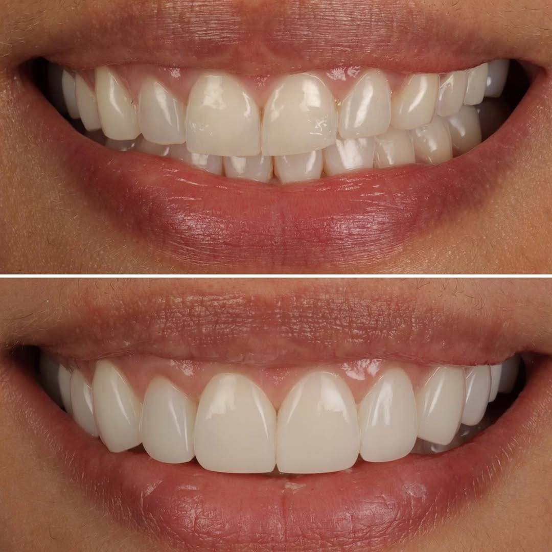Post 7 by DR PETE NIESIOLOWSKI BDS PGdip PGCert on Instagram (carousel)