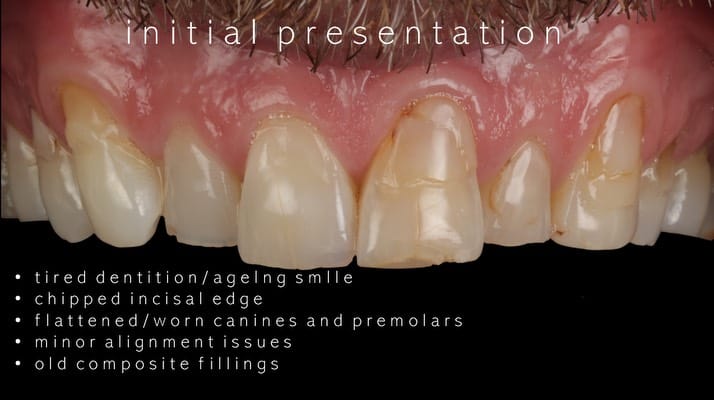 Post 3 by DR PETE NIESIOLOWSKI BDS PGdip PGCert on Instagram (carousel)