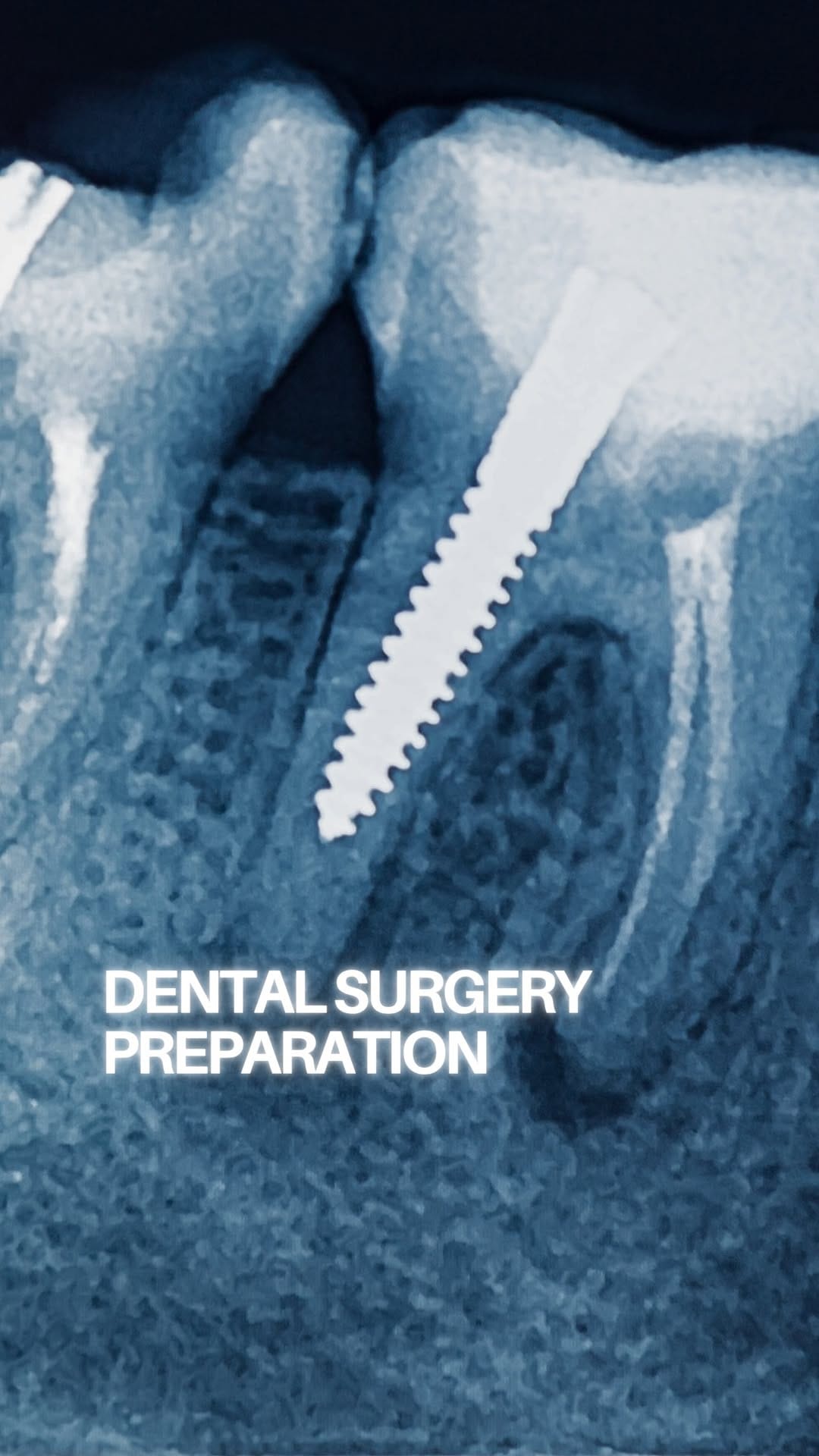 Post 5 by Dr V Sampson BDS MFDS RCS Ed on Instagram (video)