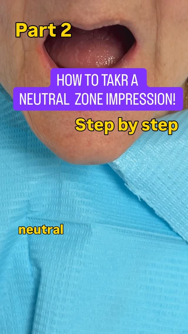Post 4 by Dr Steph BDS PGDip Rest & Aesthetics (Distinction) on Instagram (video)