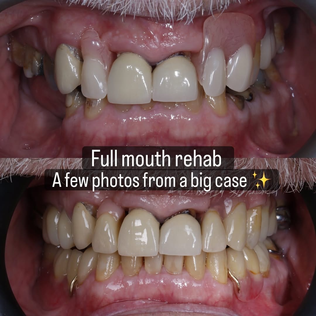 Post 6 by Dr Steph BDS PGDip Rest & Aesthetics (Distinction) on Instagram (carousel)