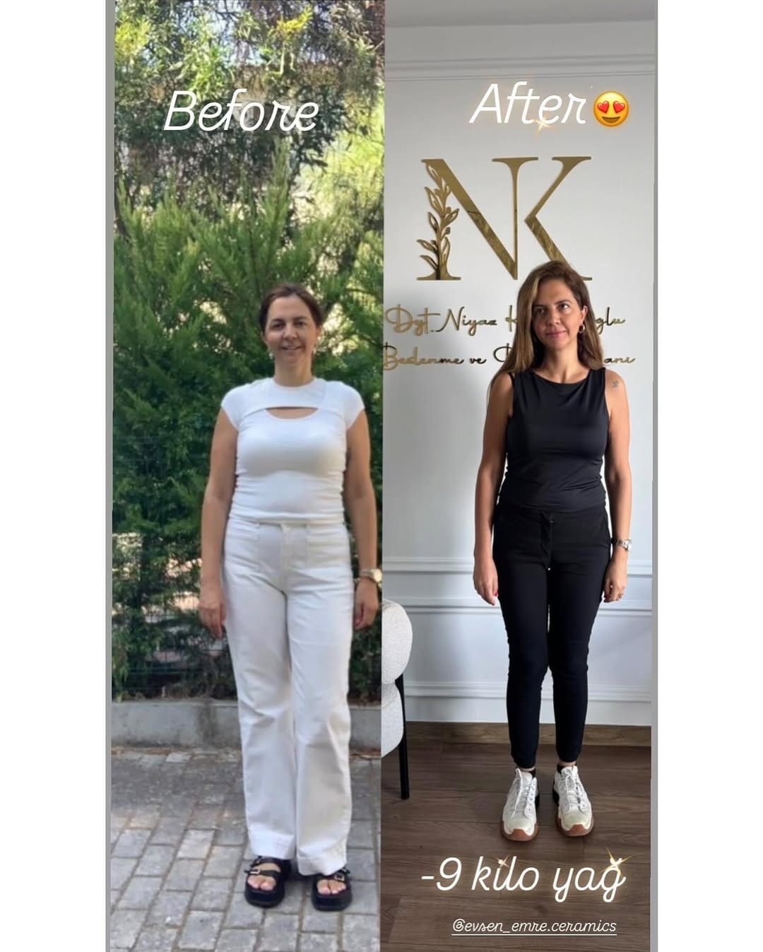 Post 8 by NK Sağlıklı Yaşam Merkezi on Instagram (image)