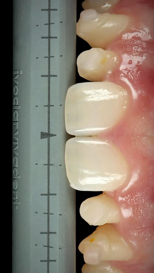 Post 6 by Dr. Ambrish Roshan on Instagram (video)