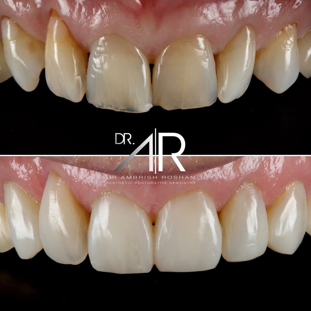 Post 2 by Dr. Ambrish Roshan on Instagram (carousel)