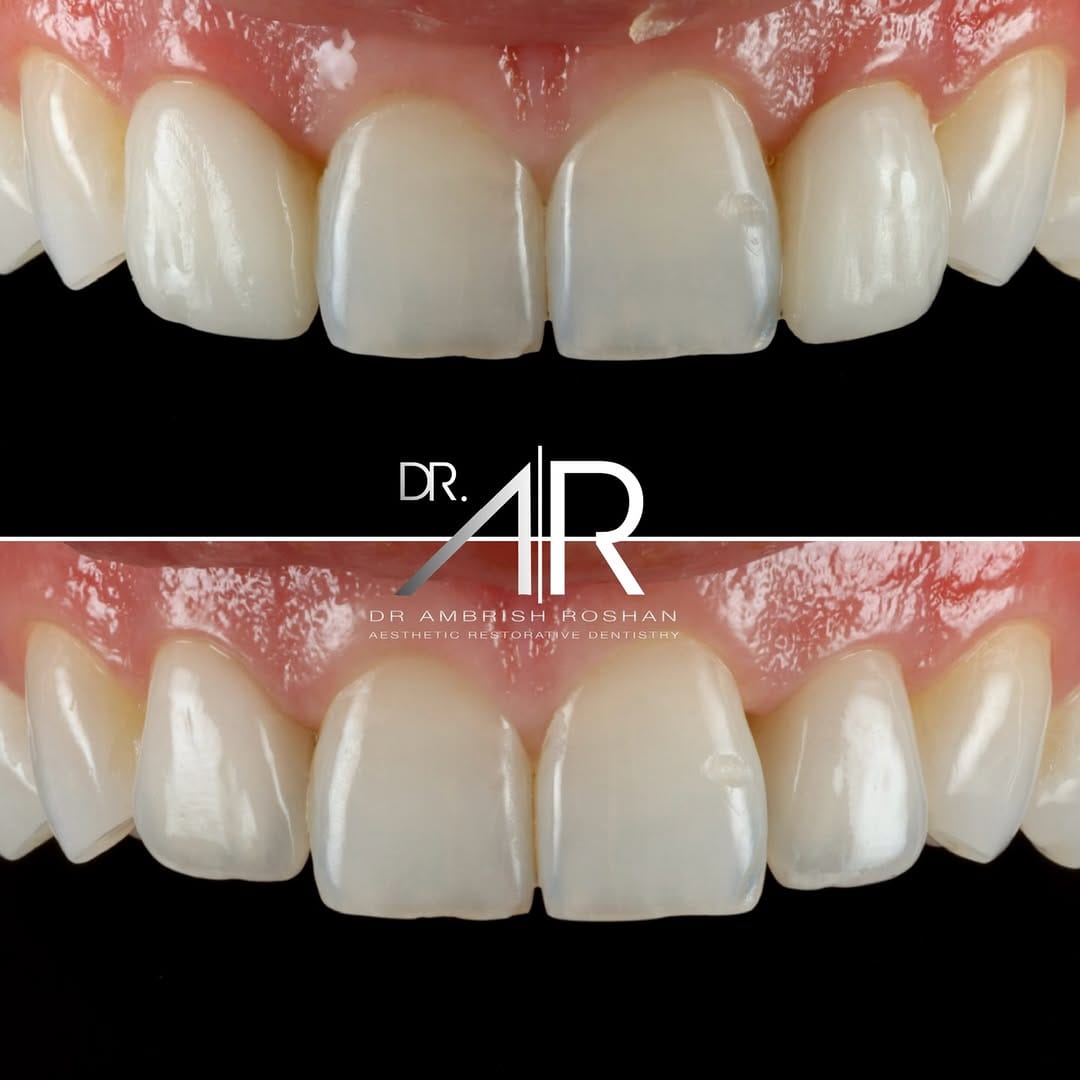 Post 8 by Dr. Ambrish Roshan on Instagram (carousel)
