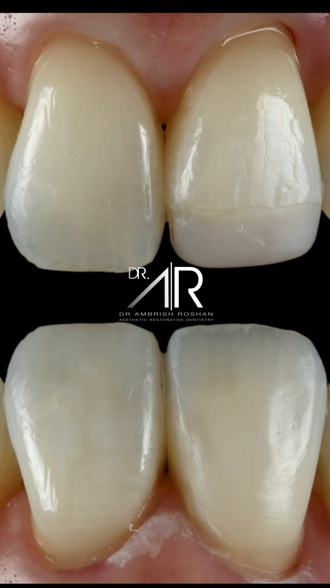 Post 5 by Dr. Ambrish Roshan on Instagram (video)