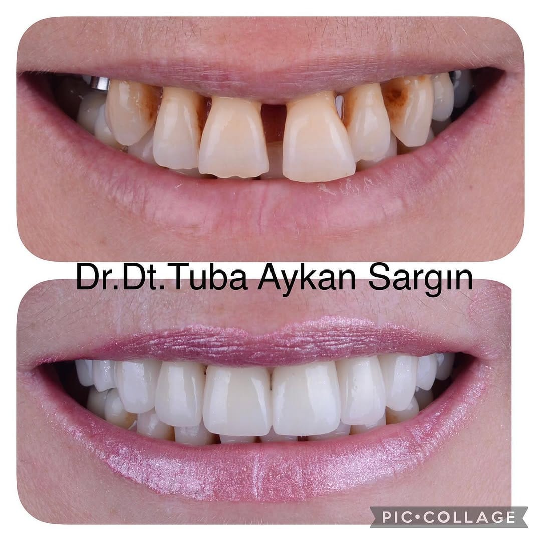 Post 9 by Dr.Dt. Tuba AYKAN SARGIN on Instagram (image)