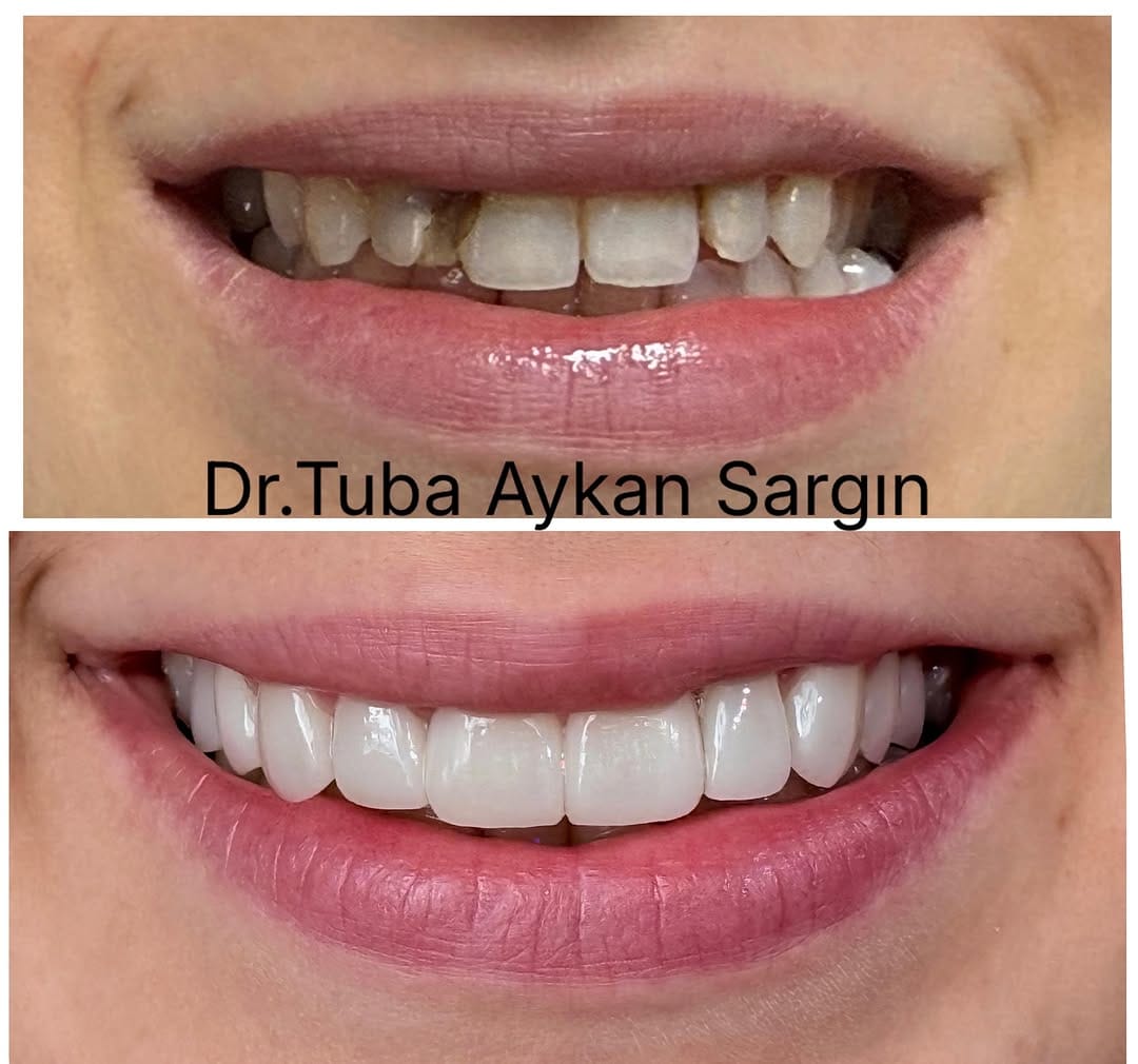 Post 3 by Dr.Dt. Tuba AYKAN SARGIN on Instagram (image)