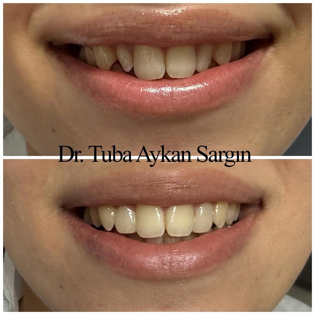 Post 4 by Dr.Dt. Tuba AYKAN SARGIN on Instagram (image)