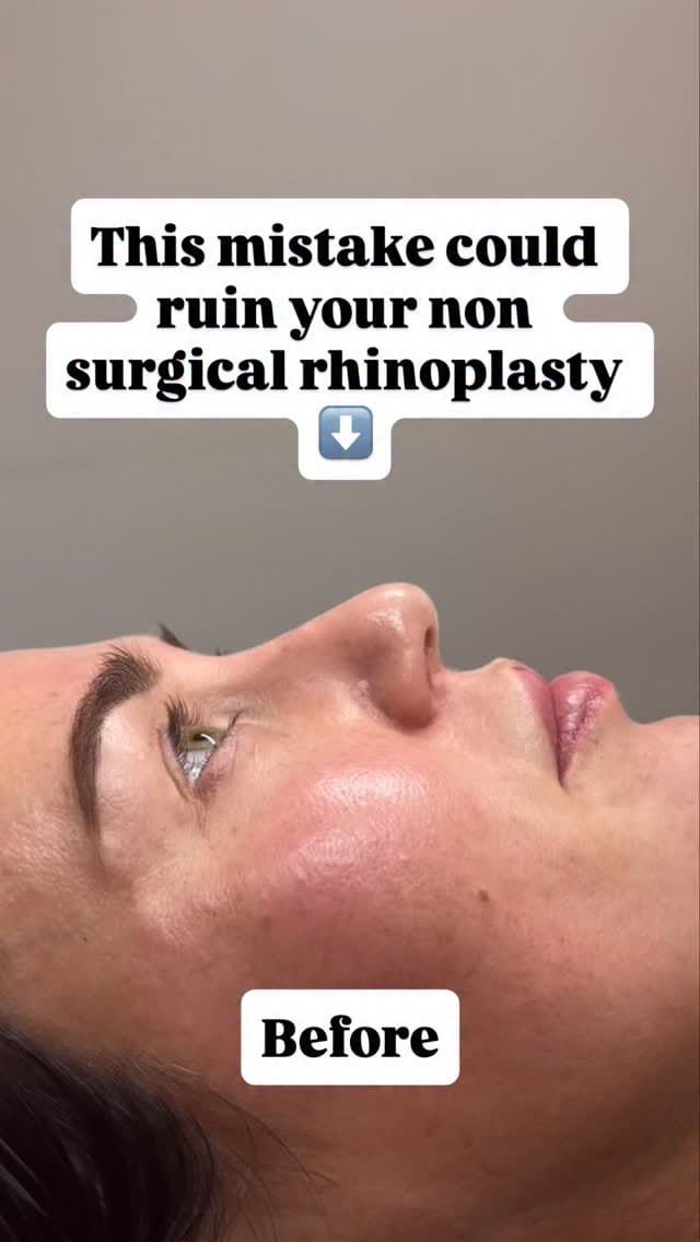 Post 4 by Samantha Price - SCP AESTHETICS on Instagram (video)