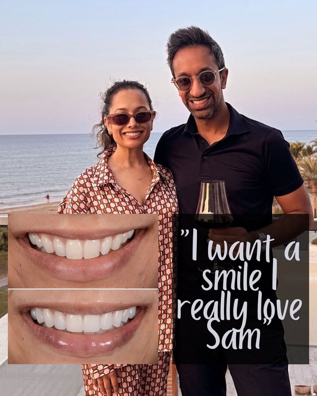 Post 8 by Bespoke Smile on Instagram (video)