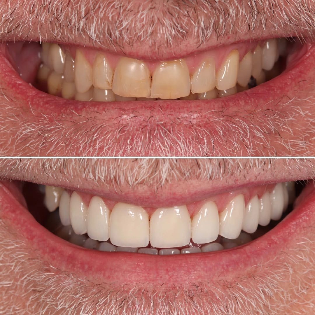 Post 5 by Bespoke Smile on Instagram (carousel)