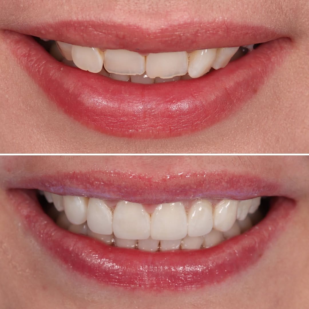 Post 1 by Bespoke Smile on Instagram (carousel)