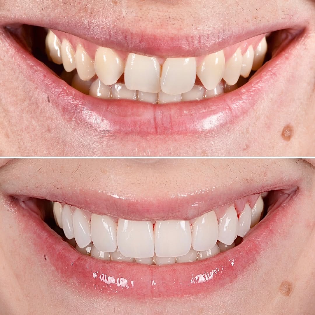 Post 7 by Bespoke Smile on Instagram (carousel)