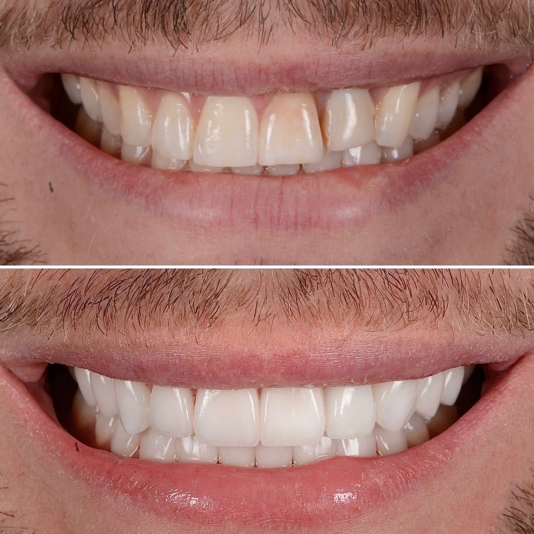 Post 3 by Bespoke Smile on Instagram (carousel)