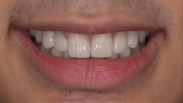 Post 3 by Dr. Cem Baysal on Instagram (video)