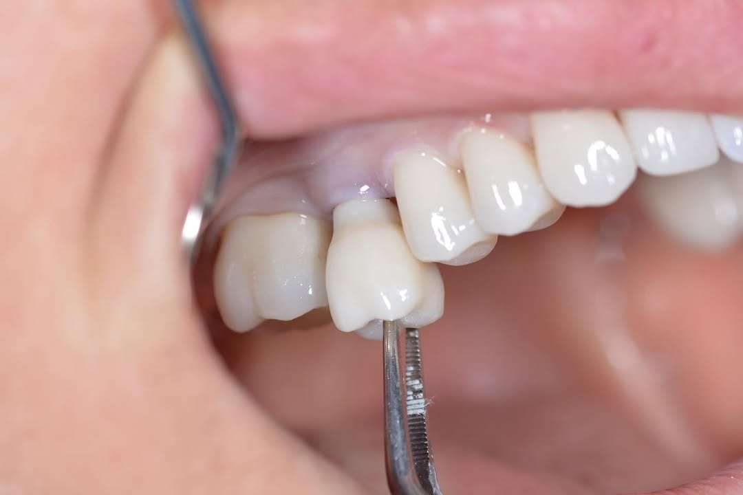 Post 7 by Dr. Cem Baysal on Instagram (image)