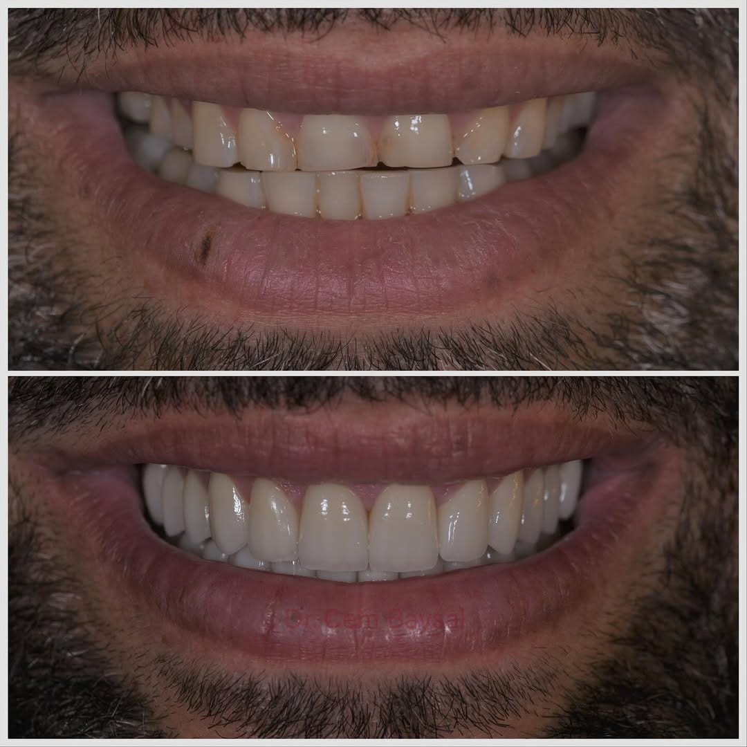 Post 5 by Dr. Cem Baysal on Instagram (carousel)