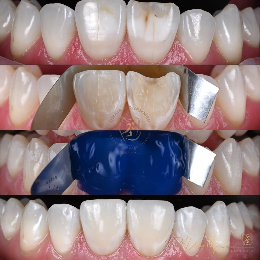 Post 7 by Dr Umair Mohammed | Cosmetic & Sports Dentist | 📍 Edinburgh on Instagram (image)