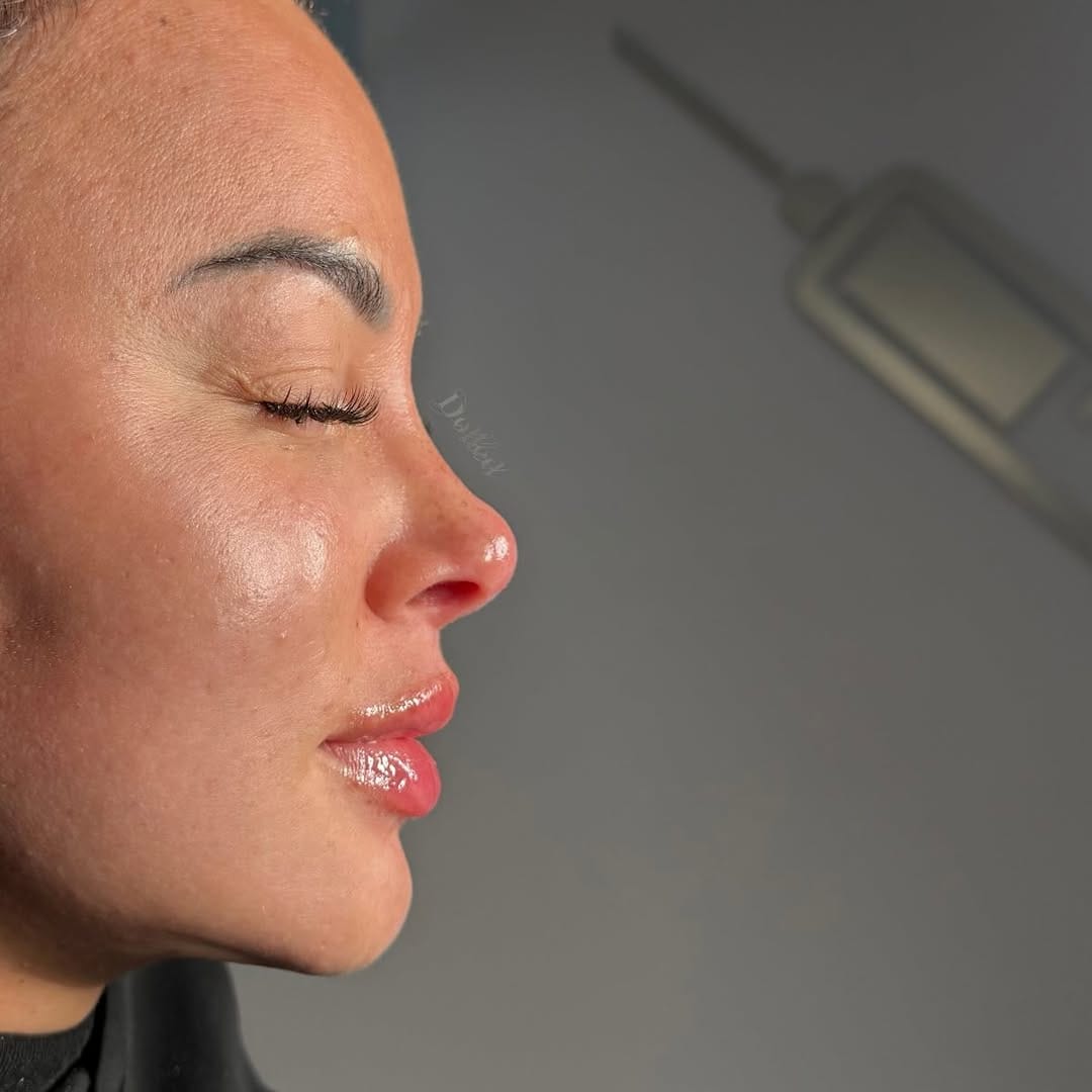 Post 10 by 𝐑𝐨𝐦𝐚 𝐃𝐚𝐥𝐞𝐲 | 𝐃𝐎𝐋𝐋𝐄𝐃 𝐀𝐄𝐒𝐓𝐇𝐄𝐓𝐈𝐂𝐒® | 𝐋𝟕 𝐍𝐔𝐑𝐒𝐄 𝐏𝐑𝐄𝐒𝐂𝐑𝐈𝐁𝐄𝐑 on Instagram (carousel)