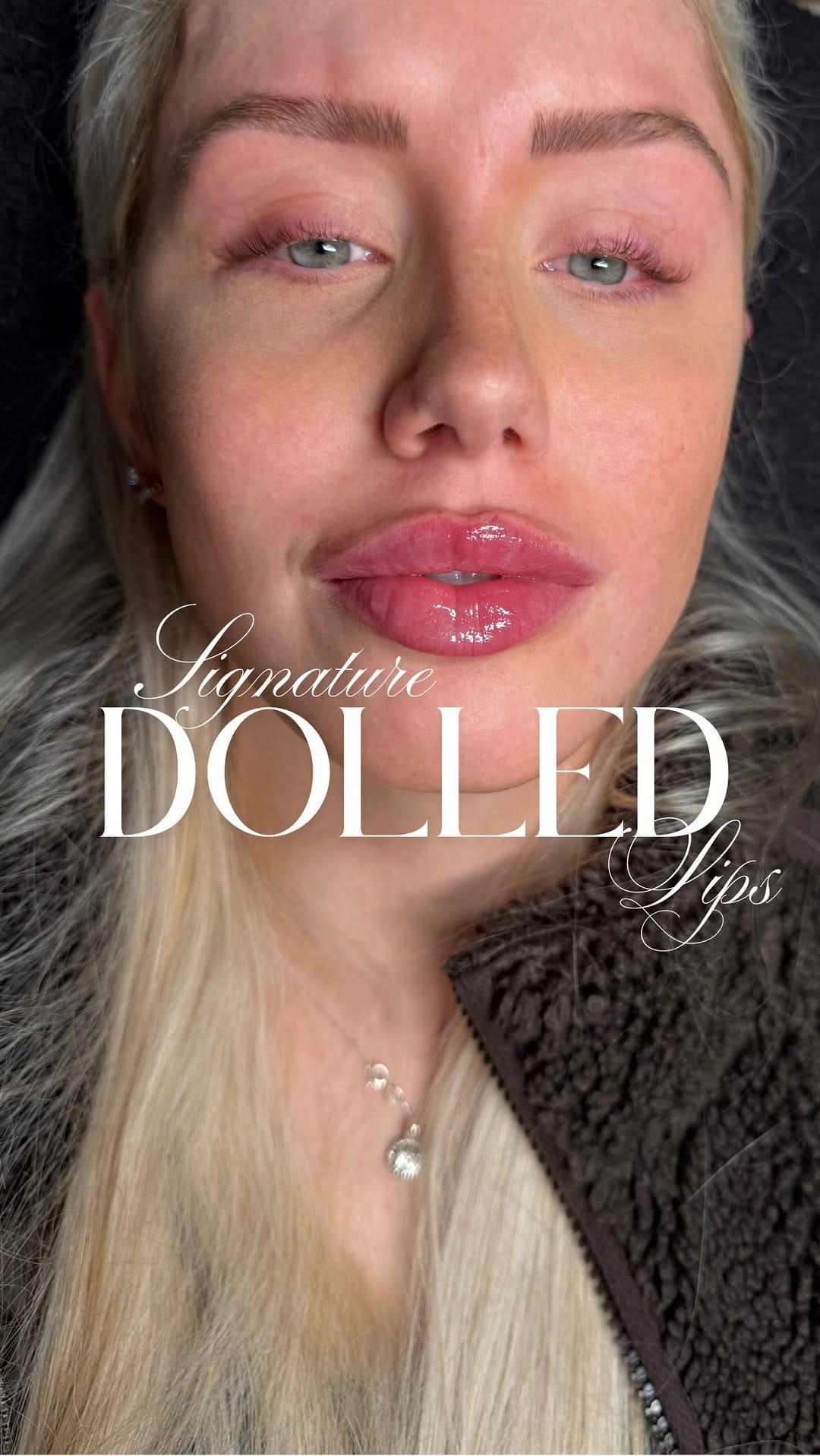 Post 7 by 𝐑𝐨𝐦𝐚 𝐃𝐚𝐥𝐞𝐲 | 𝐃𝐎𝐋𝐋𝐄𝐃 𝐀𝐄𝐒𝐓𝐇𝐄𝐓𝐈𝐂𝐒® | 𝐋𝟕 𝐍𝐔𝐑𝐒𝐄 𝐏𝐑𝐄𝐒𝐂𝐑𝐈𝐁𝐄𝐑 on Instagram (video)