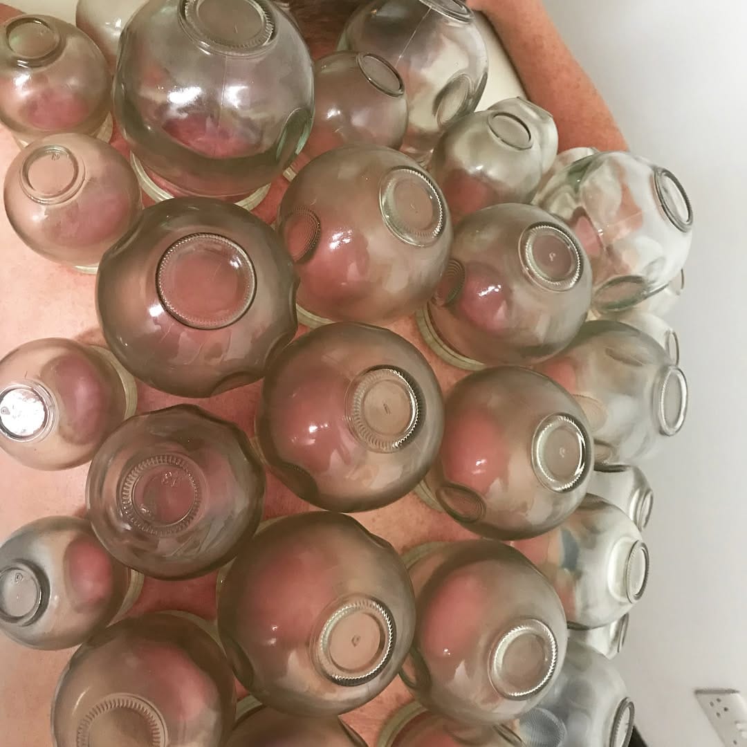 Post 9 by CuppingTherapyLiverpool on Instagram (carousel)