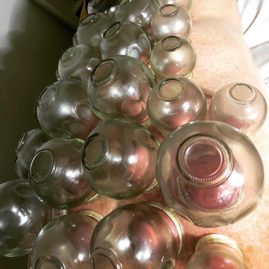 Post 2 by CuppingTherapyLiverpool on Instagram (image)