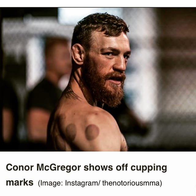 Post 7 by CuppingTherapyLiverpool on Instagram (carousel)