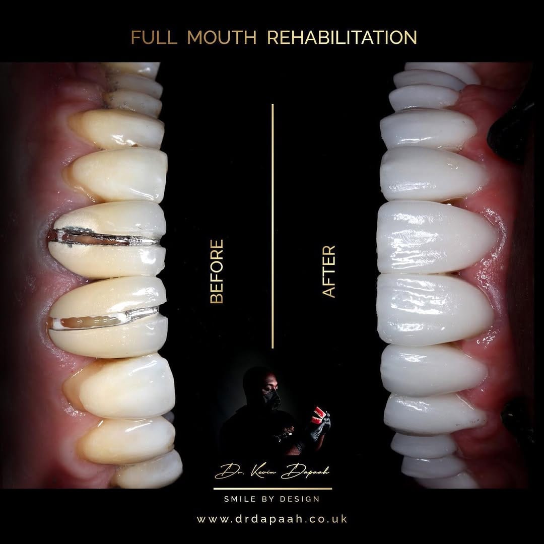 Post 10 by Dr. Dapaah - “The Peoples Dentist” ✌🏾 on Instagram (carousel)