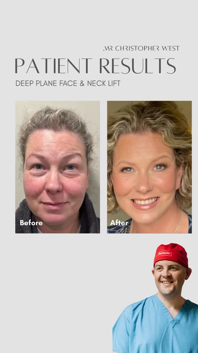 Post 8 by Coppergate Clinic | Cosmetic Surgery on Instagram (video)