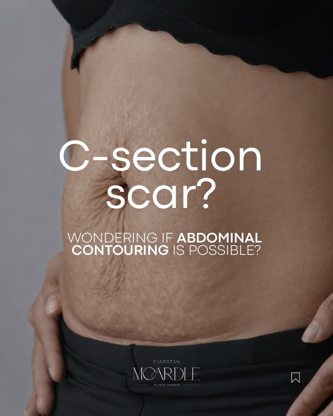 Post 6 by Coppergate Clinic | Cosmetic Surgery on Instagram (carousel)