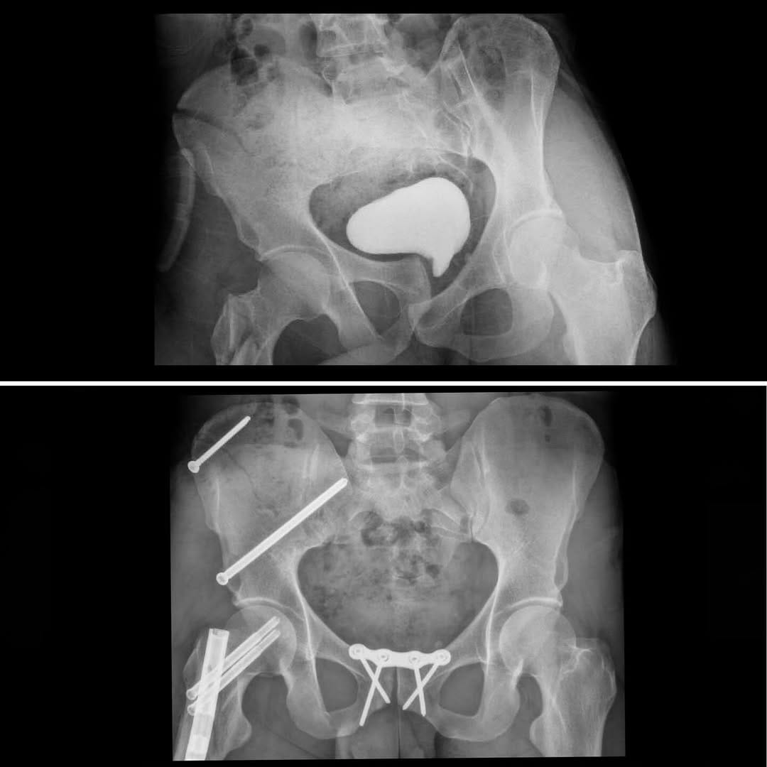 Post 1 by Ishaq Ibrahim, MD on Instagram (carousel)