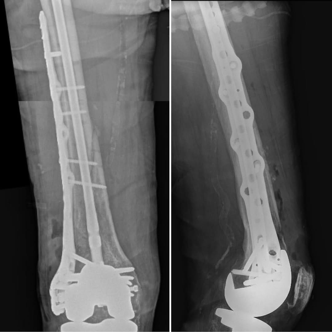 Post 5 by Ishaq Ibrahim, MD on Instagram (carousel)