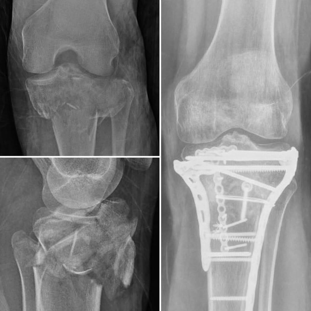 Post 9 by Ishaq Ibrahim, MD on Instagram (carousel)