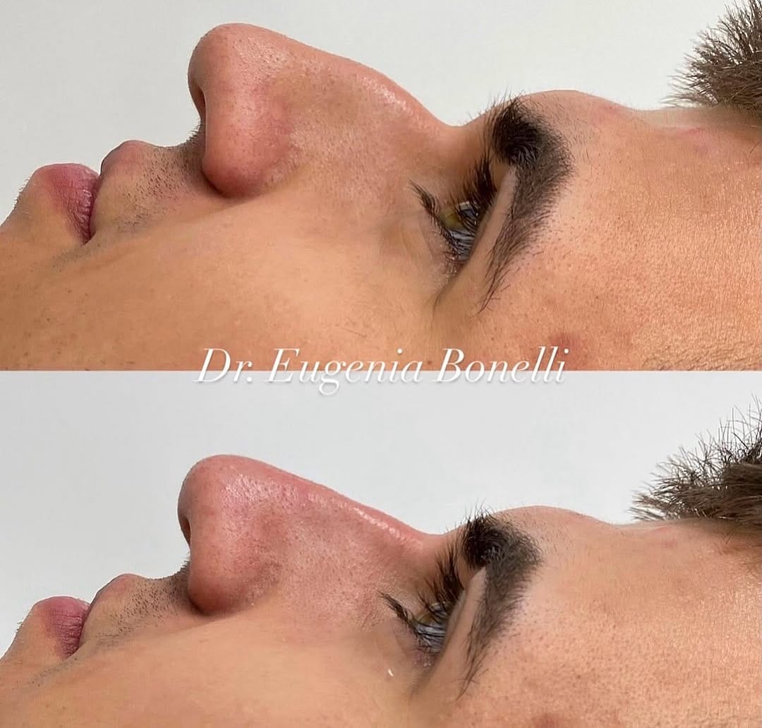 Post 4 by Dr Eugenia Bonelli👩🏻‍⚕️ 🇦🇷🇮🇹 on Instagram (image)